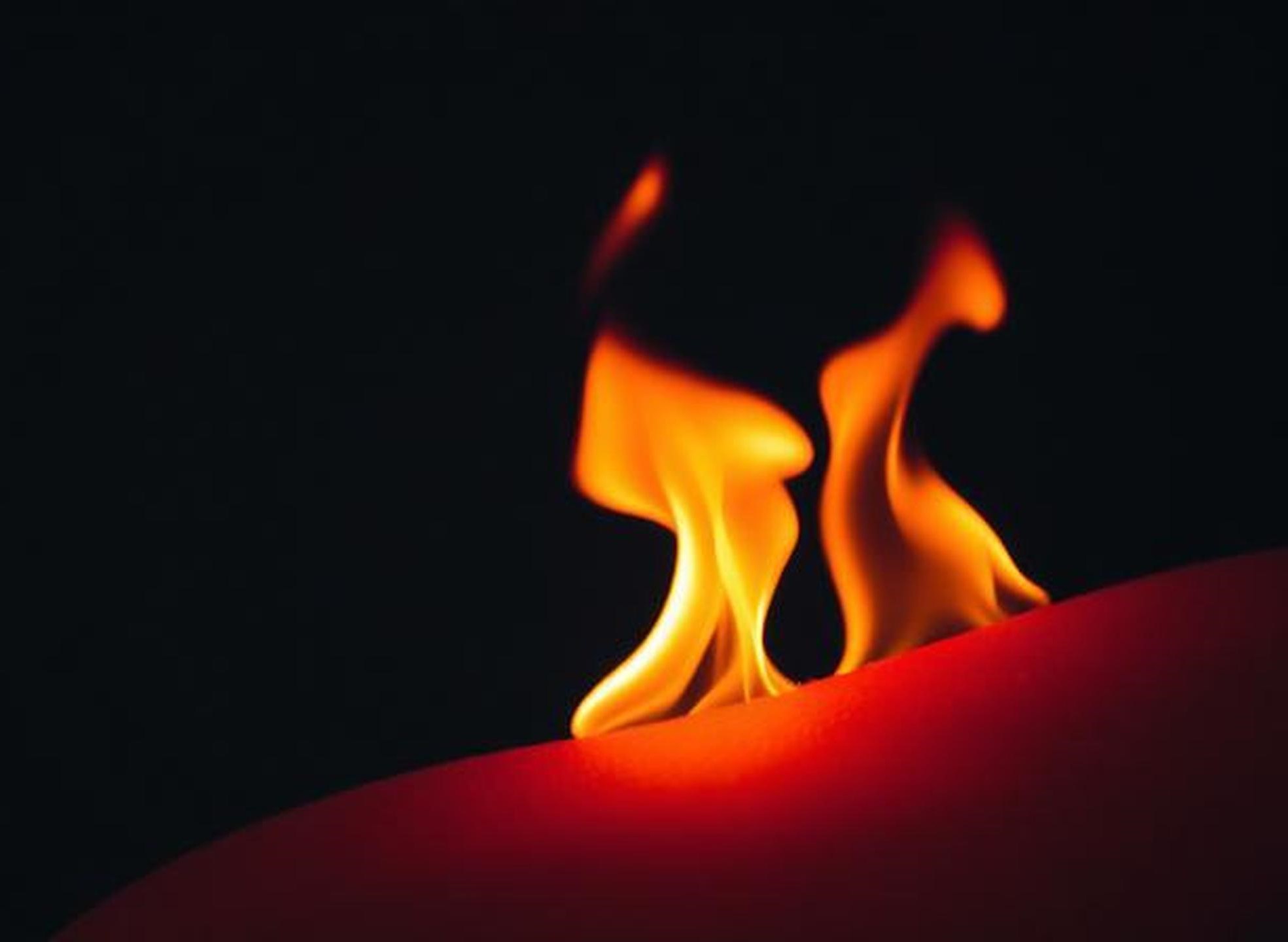 Luka bakar pada kulit yang tidak mendapatkan penanganan medis