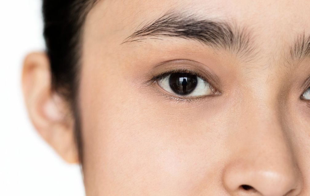 Benarkah Operasi Lasik Bisa Memicu Katarak? Ini Fakta Medisnya
