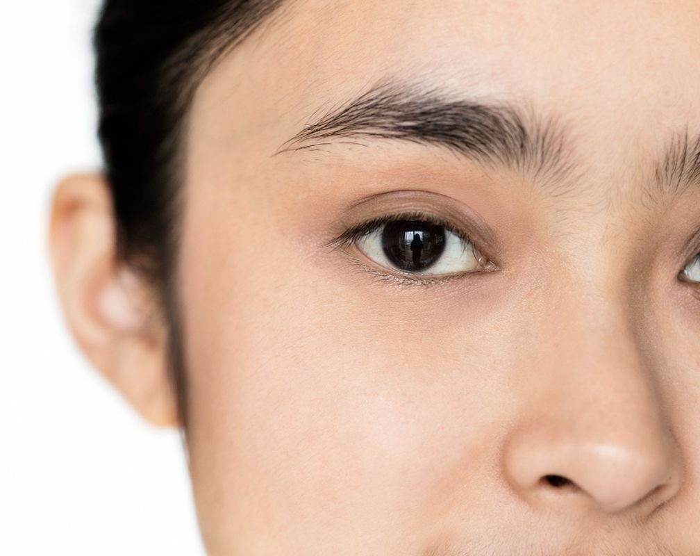 Dokter mata menjelaskan fakta operasi lasik dan risiko katarak pada pasien dengan minus tinggi