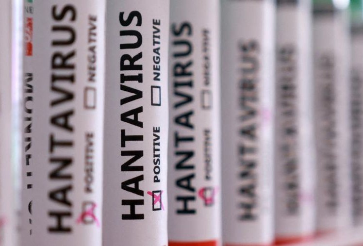 Hantavirus Sebabkan Kepanikan, Ini Fakta Soal Vaksinnya